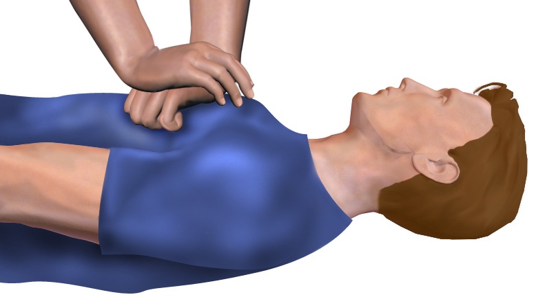 Adults CPR. Source: Wiki commons